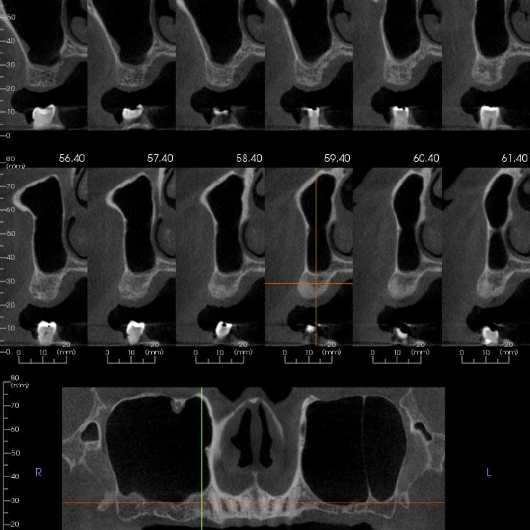 free CBCT consultation dentist near me