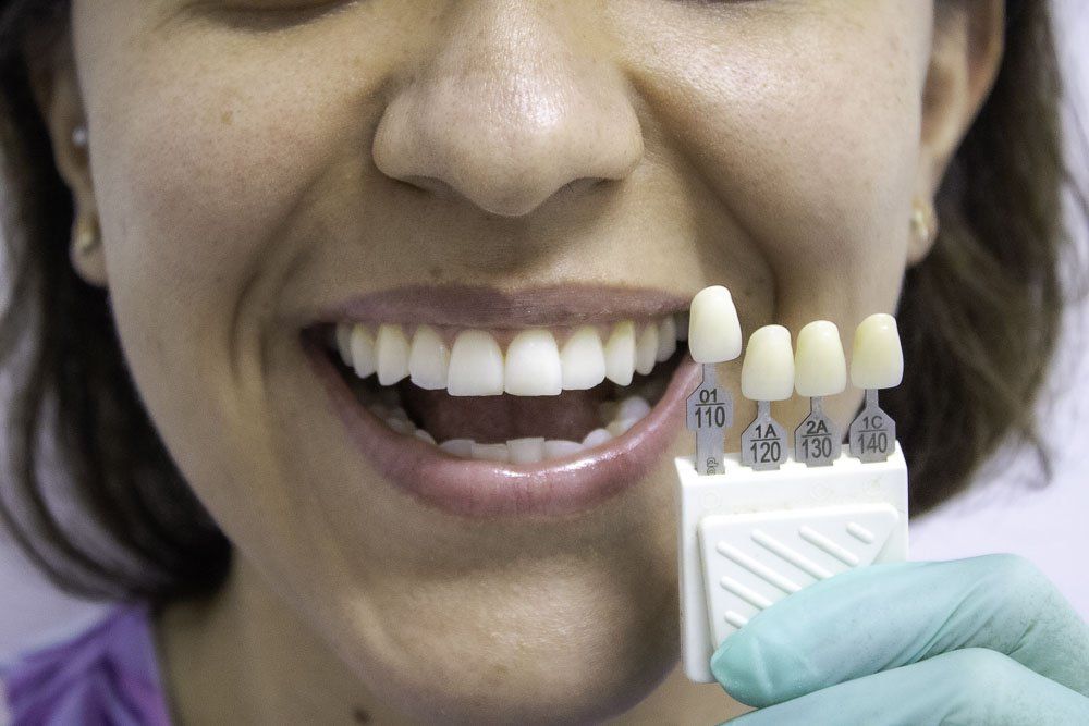 Persona sonriendo mientras sostiene muestras de color dental cerca de sus dientes.