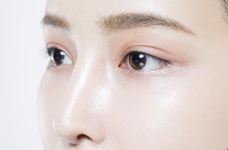 Close-up of a smooth nasal bridge after closed rhinoplasty