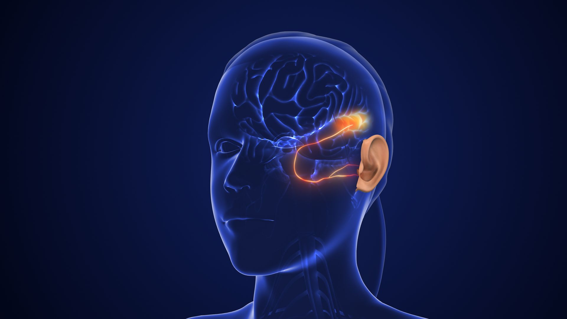 X-ray view of a woman's head showing the auditory pathway and brain structures. Highlighted in orange.