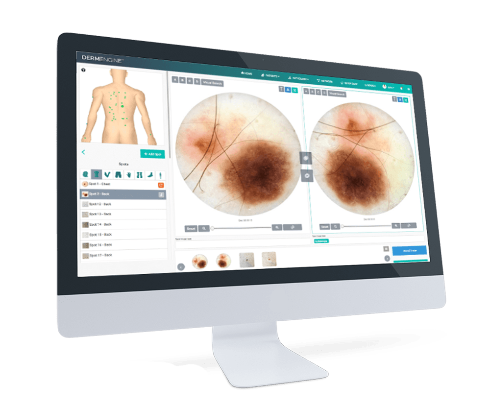 Dermengine | Somerton Park Skin Cancer Clinic