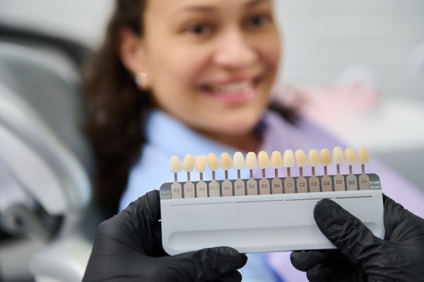 © adobeStock / Taras Grebinets Bleachingpalette vor Patientin
