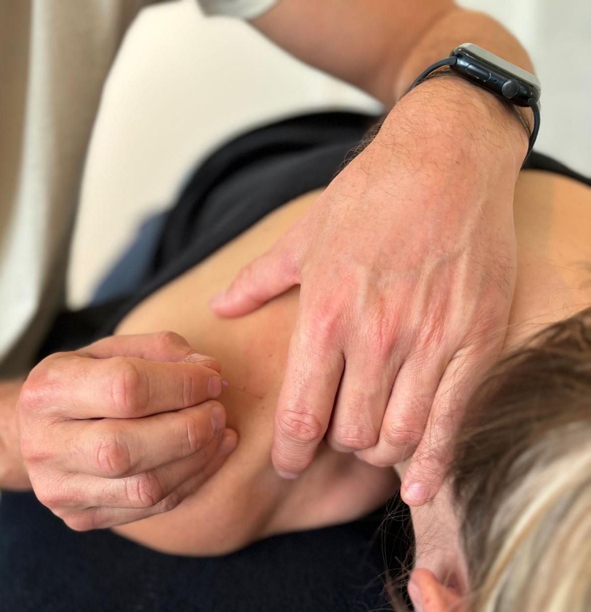 fysiotherapie dry needling