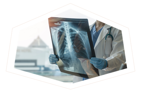 A doctor is holding an x-ray of a person 's chest.