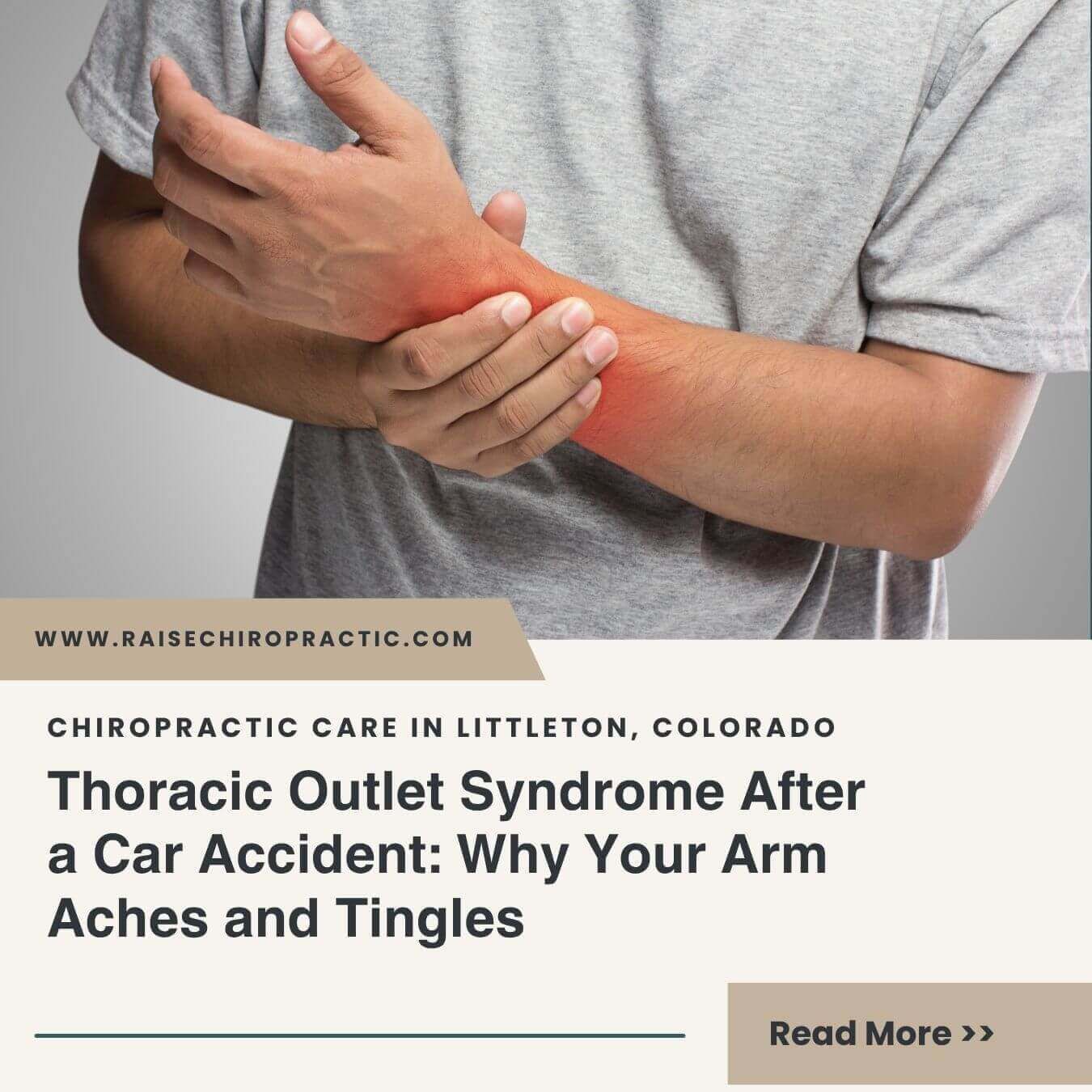Thoracic Outlet Syndrome After a Car Accident: Why Your Arm Aches and Tingles