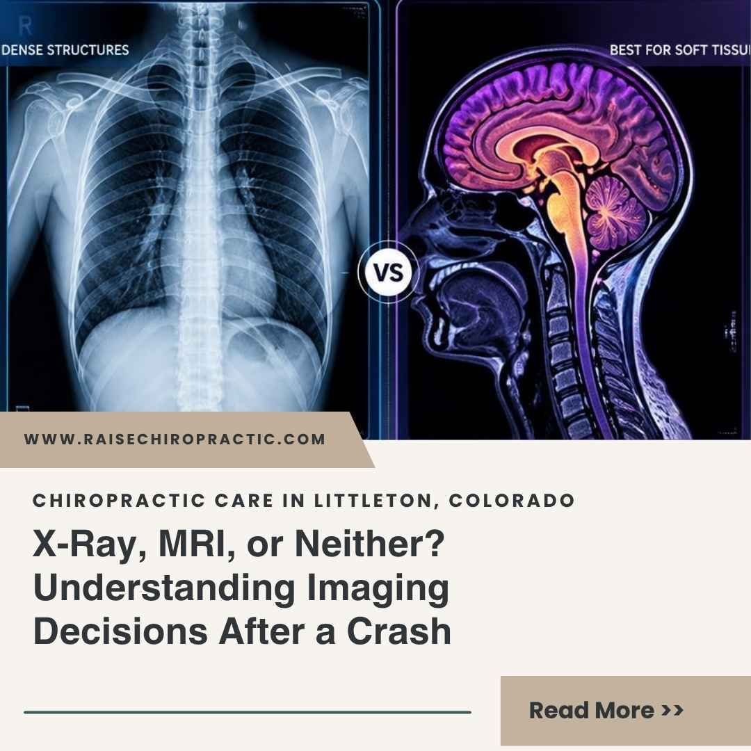 X-Ray, MRI, or Neither? Understanding Imaging Decisions After a Crash