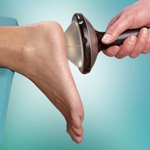 Extracorporeal Shockwave Therapy being performed on a patients foot for plantar fasciitis in Littleton, CO