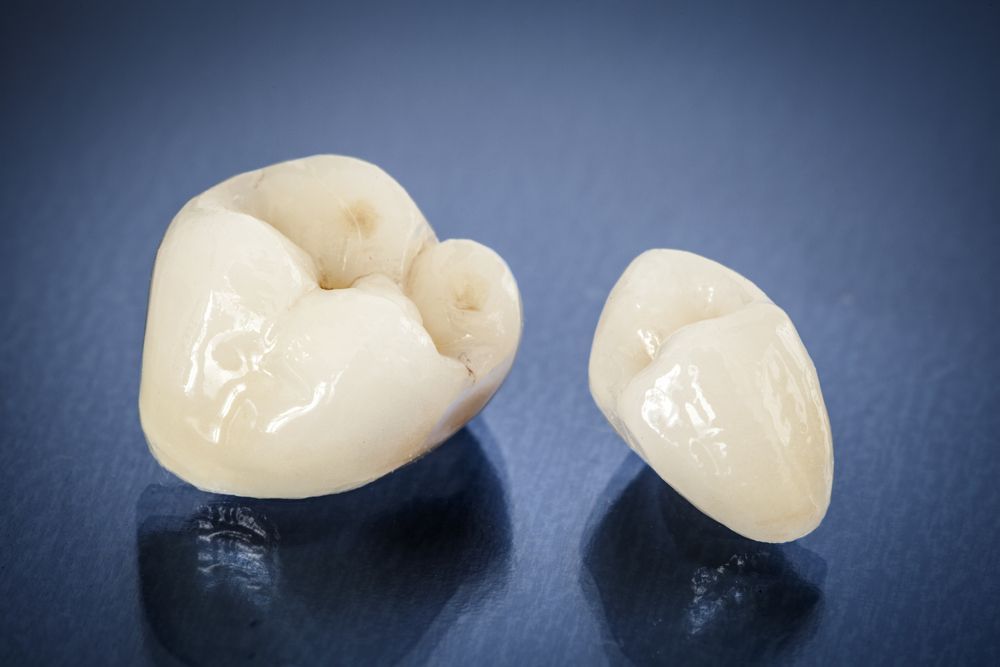 Deux couronnes dentaires en porcelaine sur une surface réfléchissante bleue.