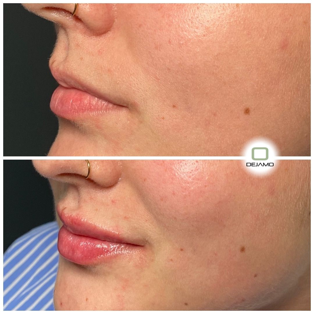 A before and after photo of a woman 's face