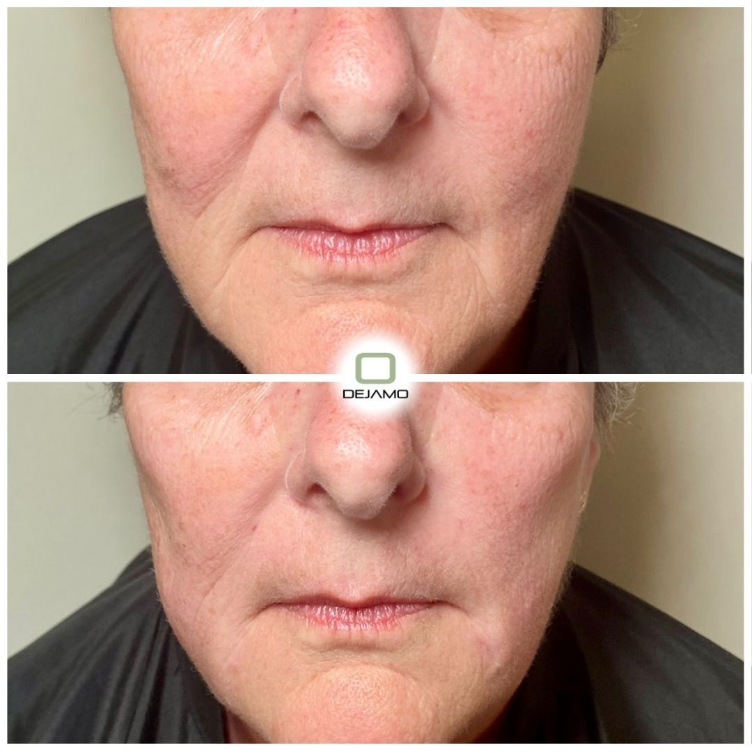 A before and after photo of a woman 's face