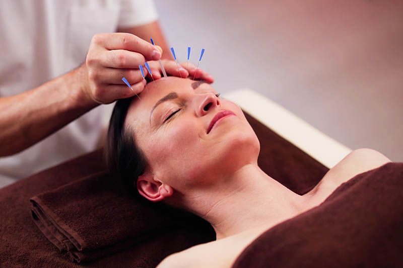 A woman is getting an acupuncture treatment on her face.