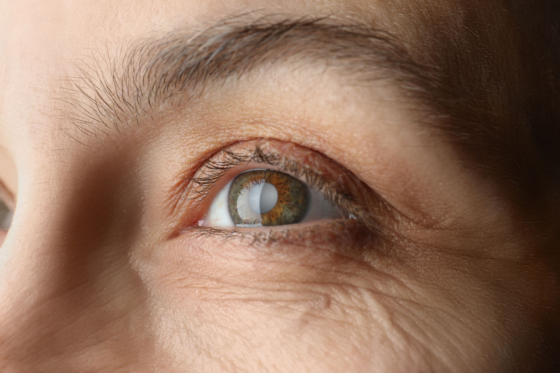 Close-up of a human eye looking upward with a light reflection in the pupil