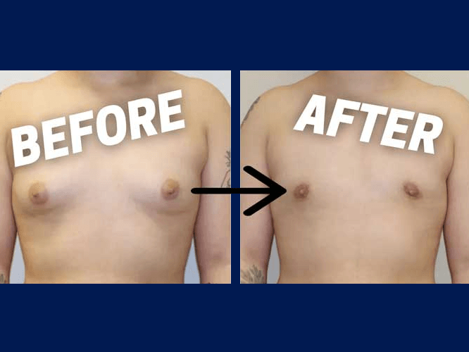 Before & After