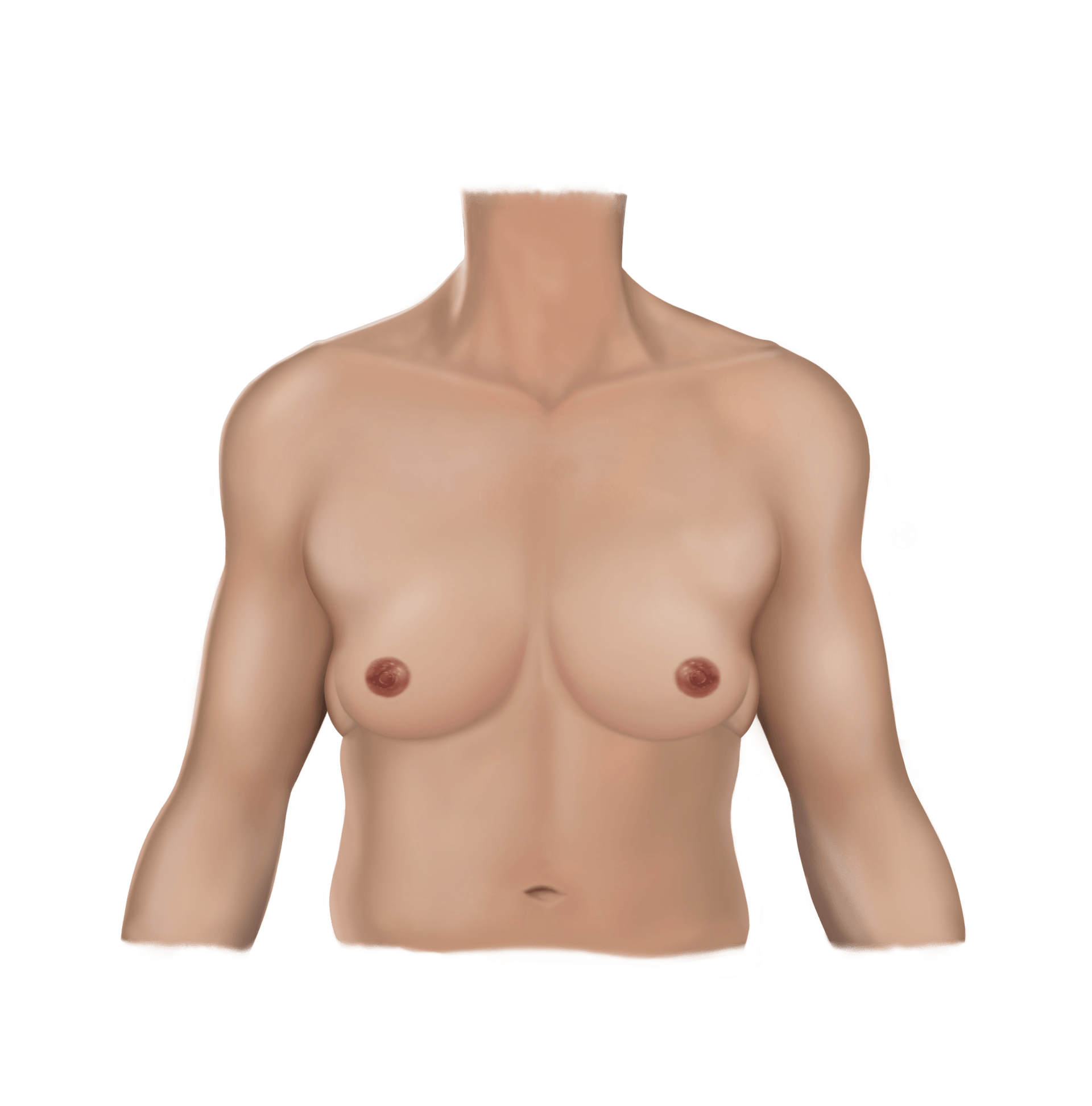 Liposuction Pre
