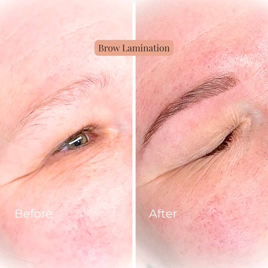 anti ageing facial treatment at Jax-Glam Beauty home salon Lyde Green Bristol