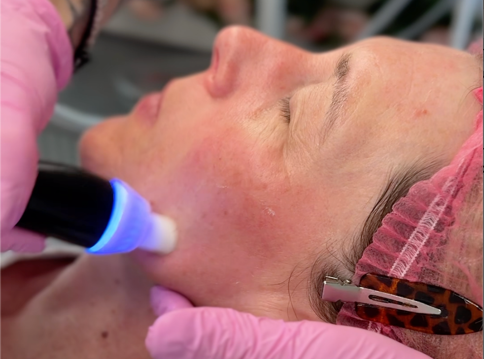 Facial for ageing skin