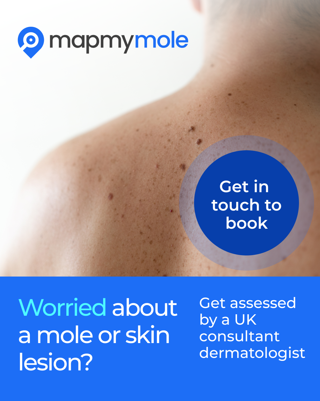 Map My Mole skin lesion screening service for checking suspicious moles