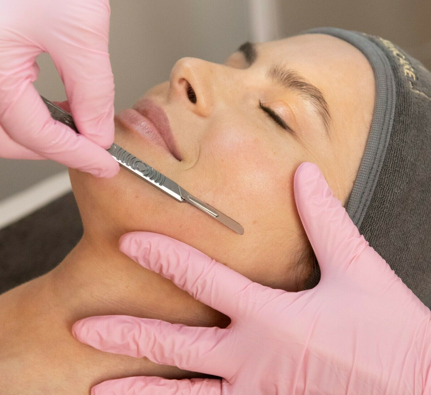 dermaplaning facial treatment at Jax Glam Beauty Bristol