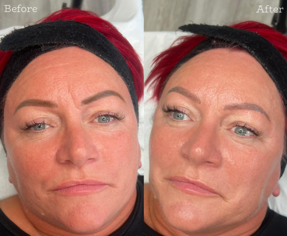 Instant Glow Skin Booster facial for brighter hydrated skin in Bristol