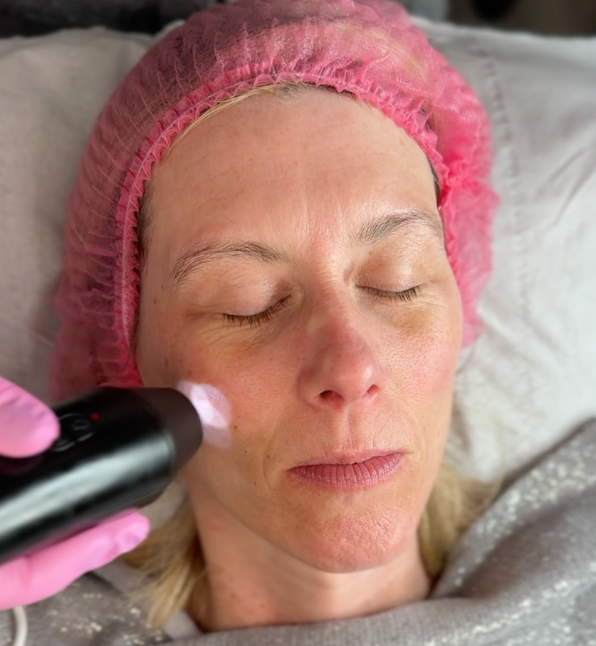 skin analysis facial treatment at Jax Glam Beauty skin clinic Bristol