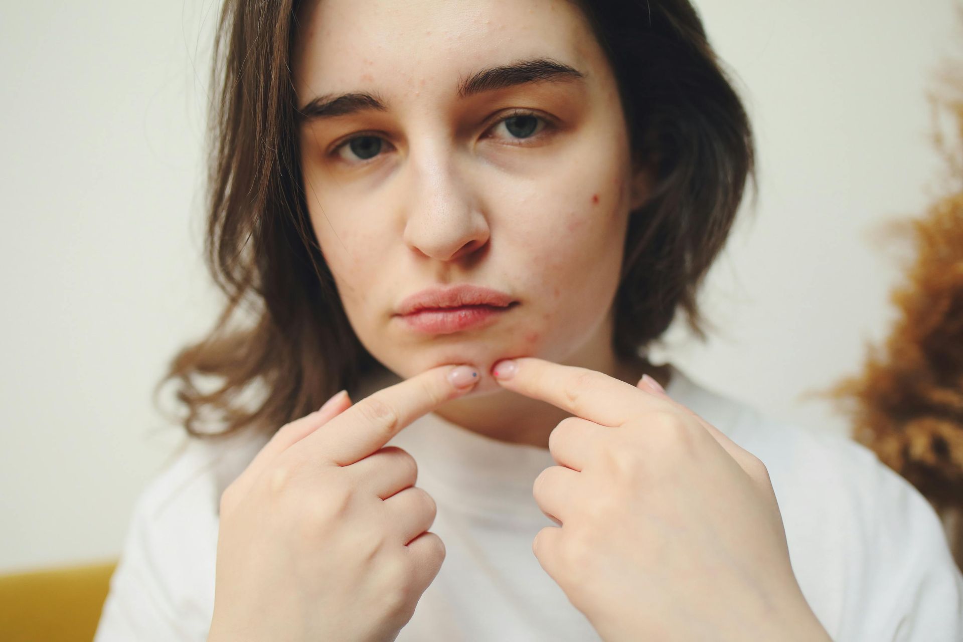Hydra dermabrasion facial treatment deeply cleansing congested, acne-prone skin to reduce breakouts 