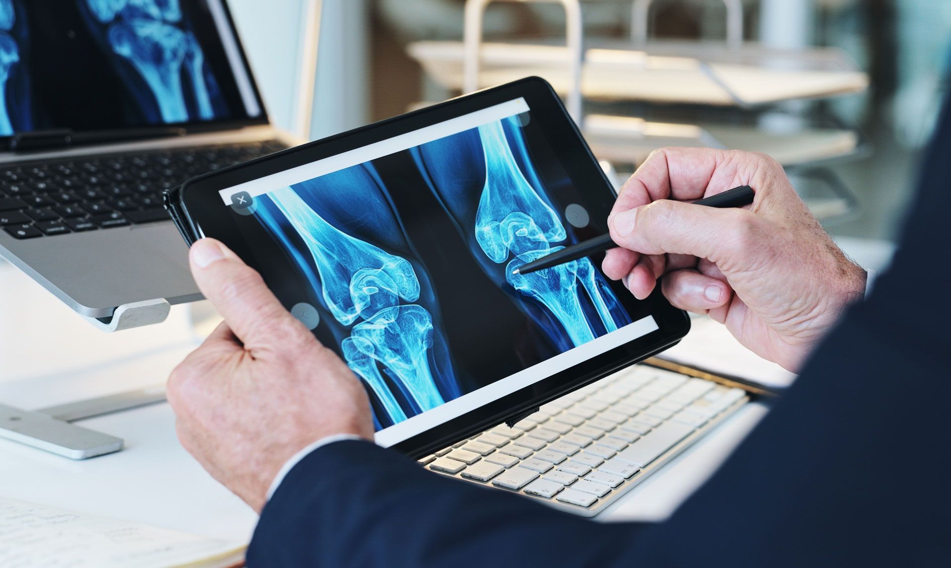 Person examines knee X-rays on a tablet with a stylus in a professional setting.