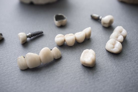 Dental Crowns