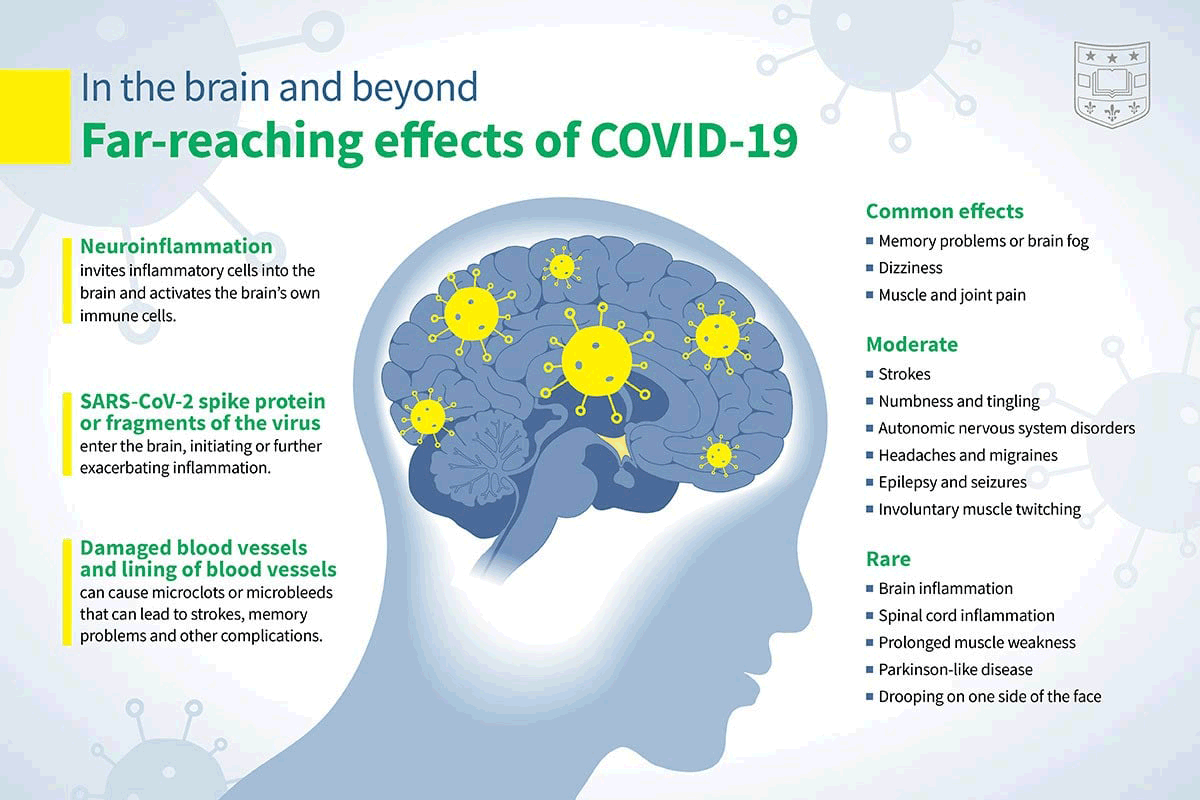 Brain fog and brain damage in SARS-CoV-2 (COVID-19).