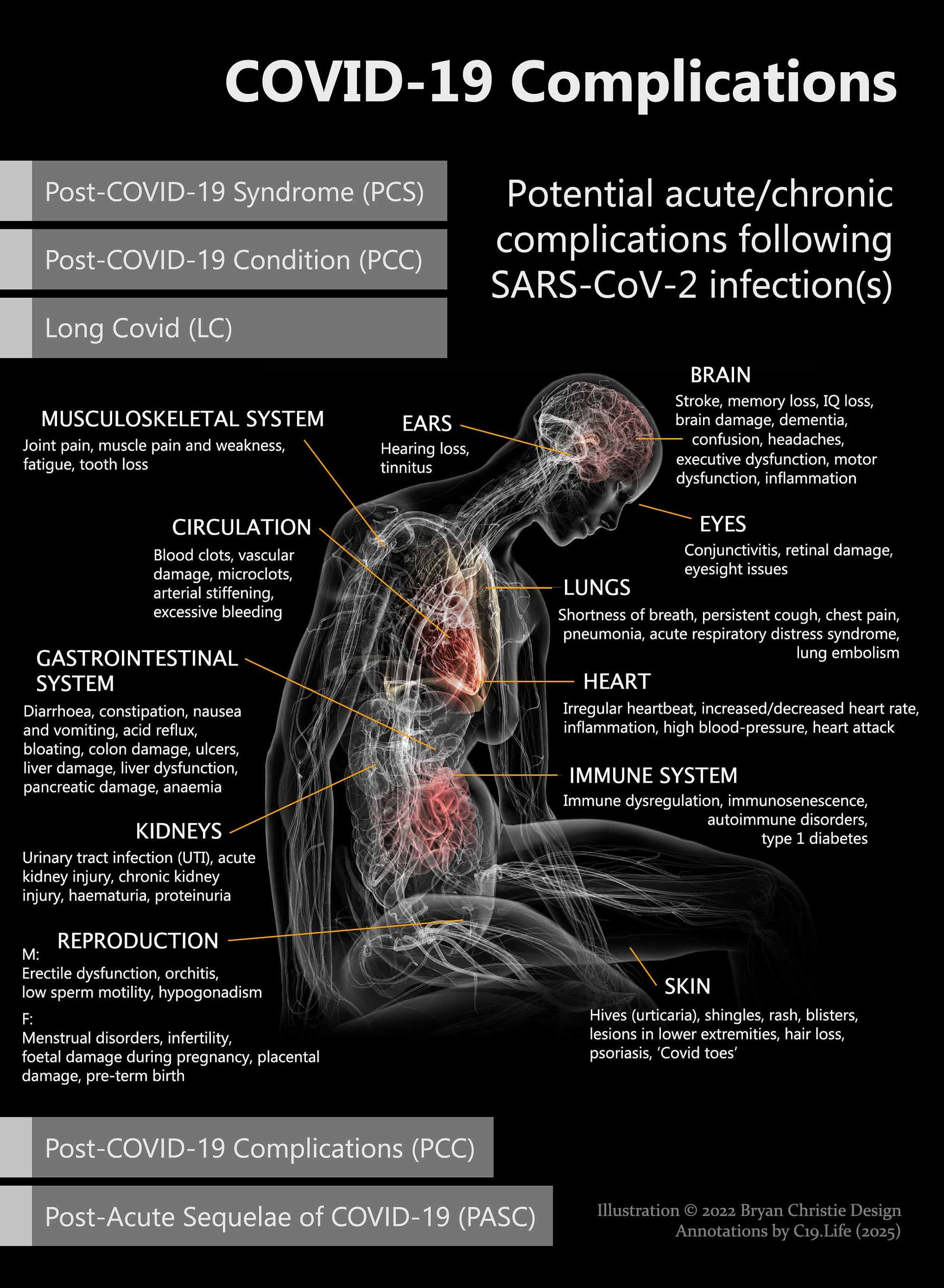 COVID-19 Complications (PASC/Long Covid): Potential acute/chronic complications following SARS-CoV-2 infection(s).