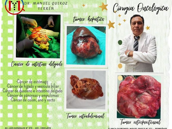 Cirugía oncológica