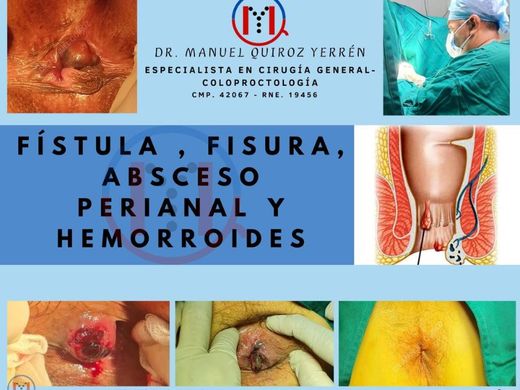 Coloproctología