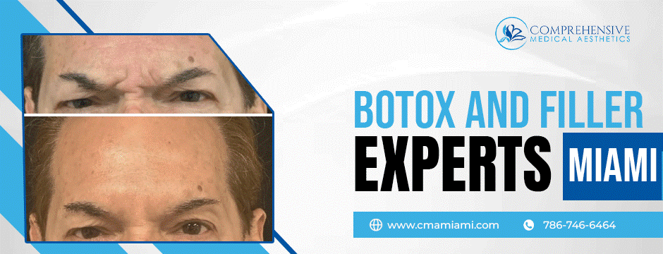 Before/after photos of eyes, Botox and Filler Experts in Miami.