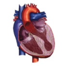 Diagram of heart with Mid-Cavity HCM