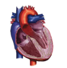 Diagram of heart with Apical HCM
