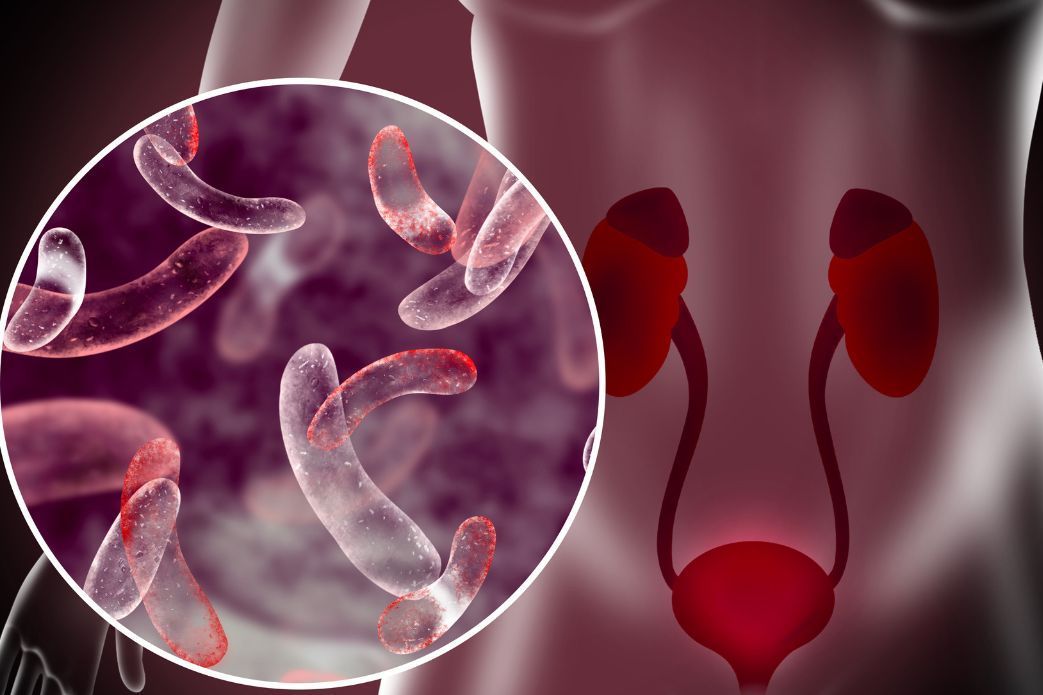 Infections urinaires