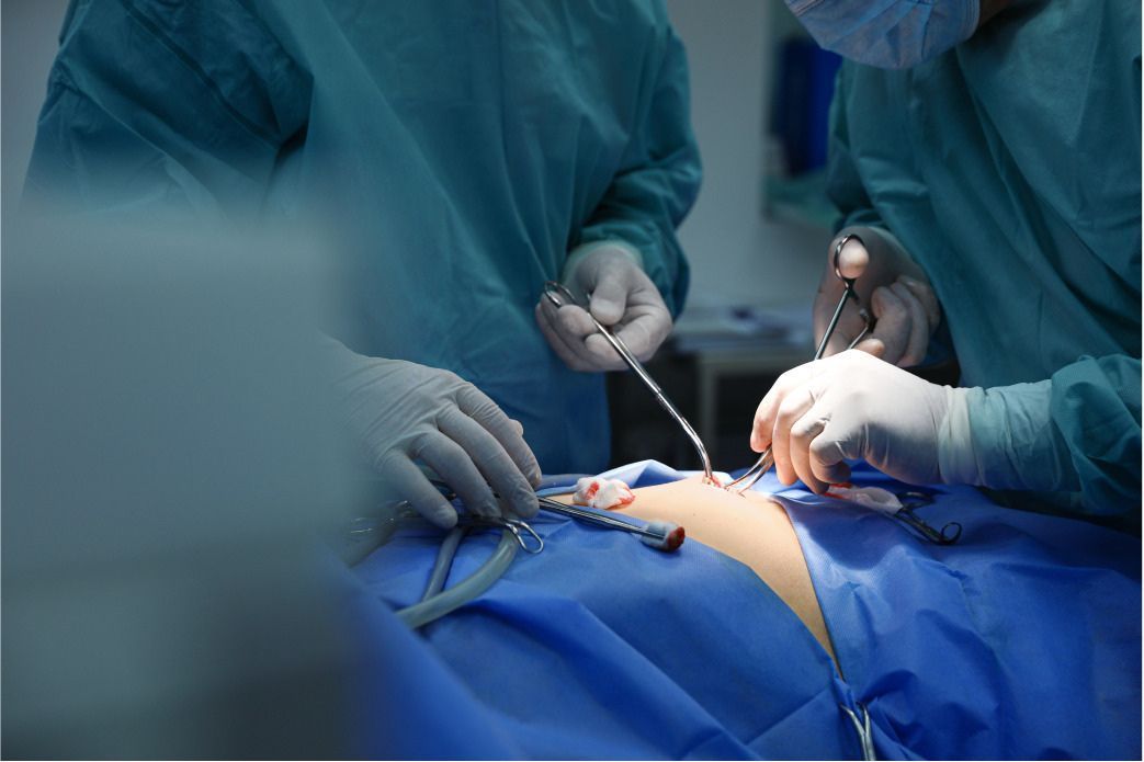 La Coeliochirurgie