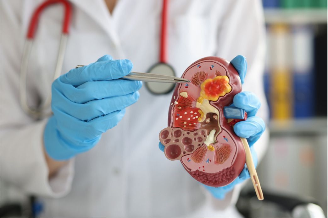 Maladies et chirurgie des reins et des voies urogénitales