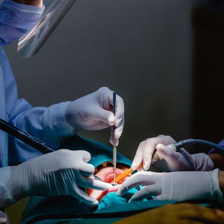 Oral Surgery