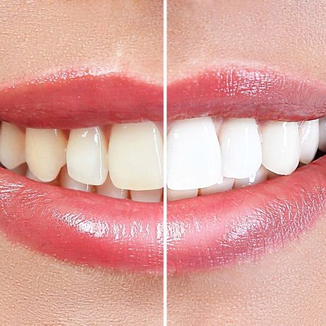 Cosmetic Dentistry