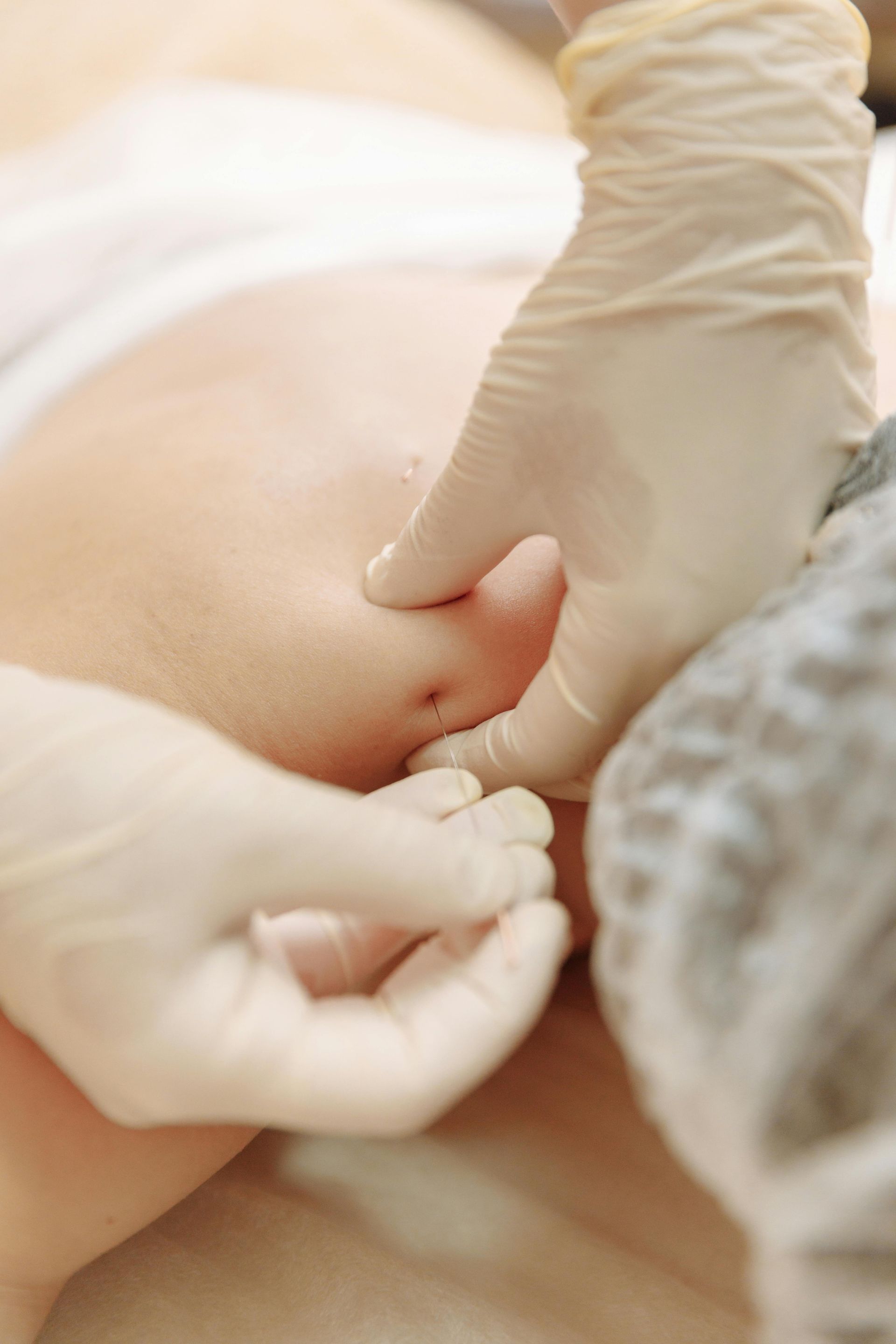 Hands in gloves performing a skin procedure on a person's back.
