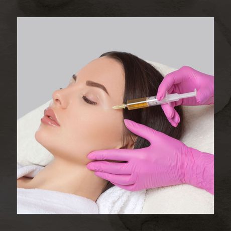 PRF Platelet Injections