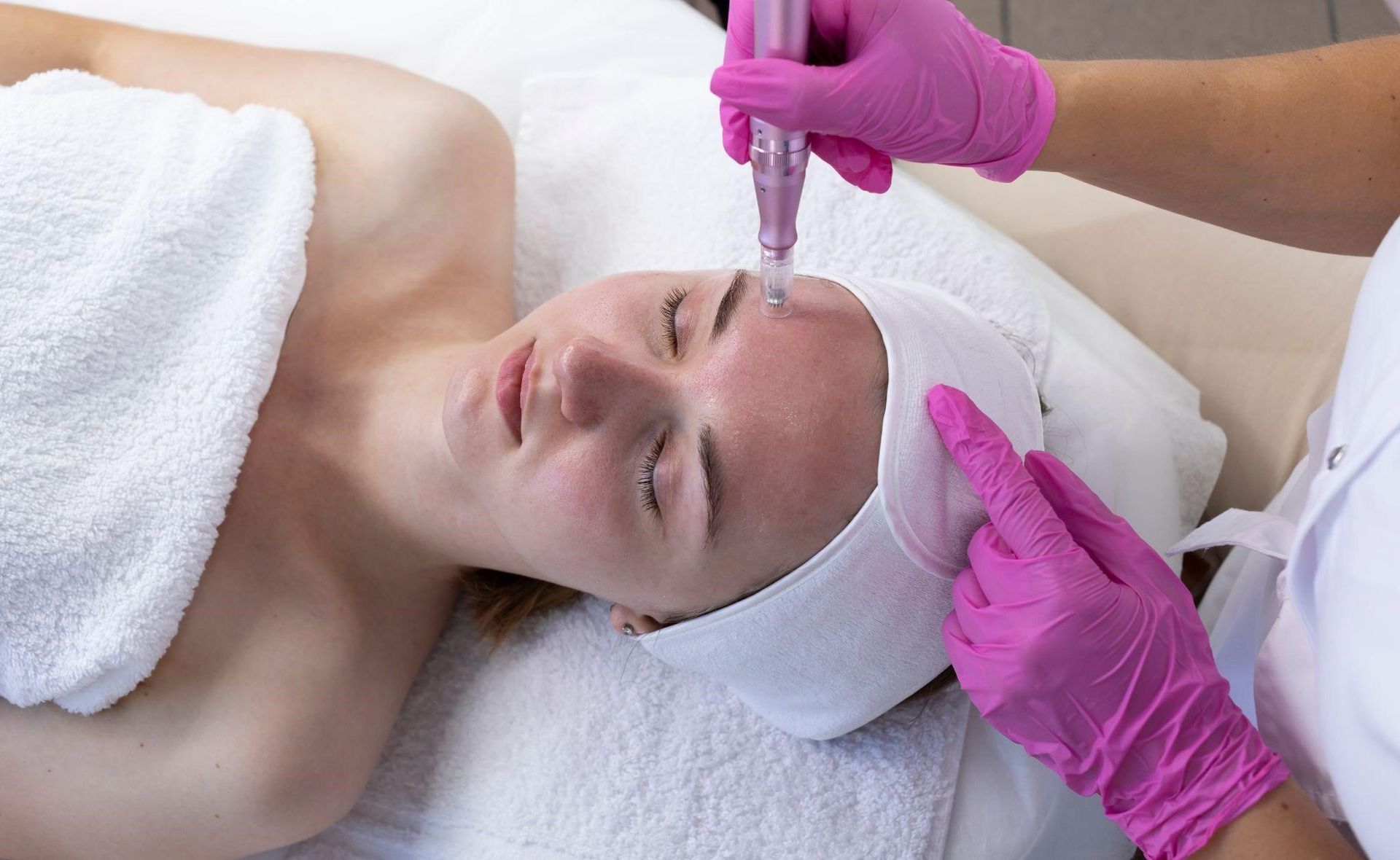 Essential Tips for the Best Microneedling Results