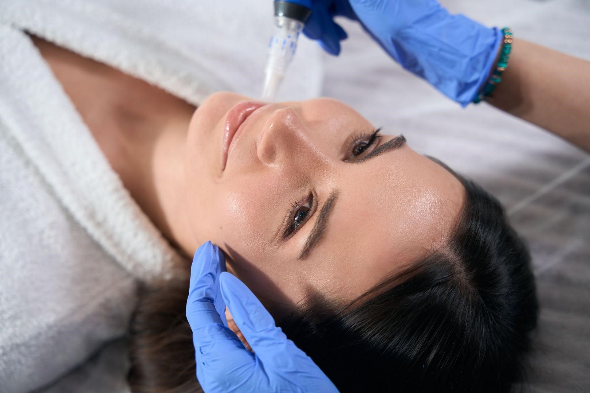 Microneedling Treatment in Normal, IL