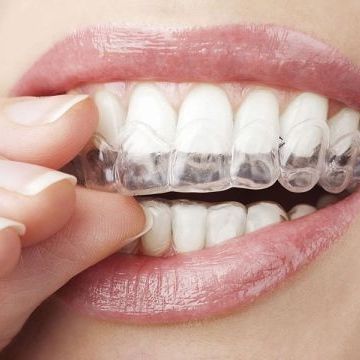 invisalign