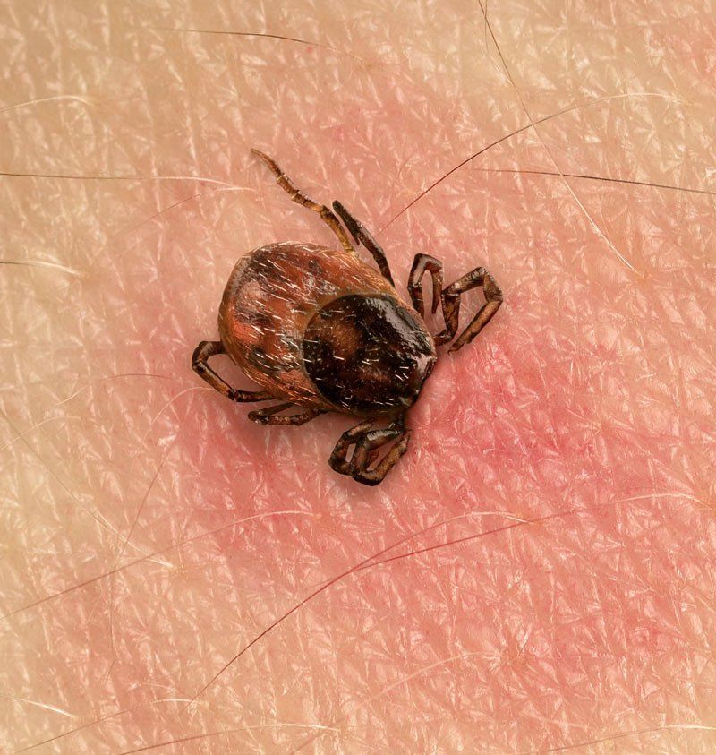A close up of a tick on a person 's skin.