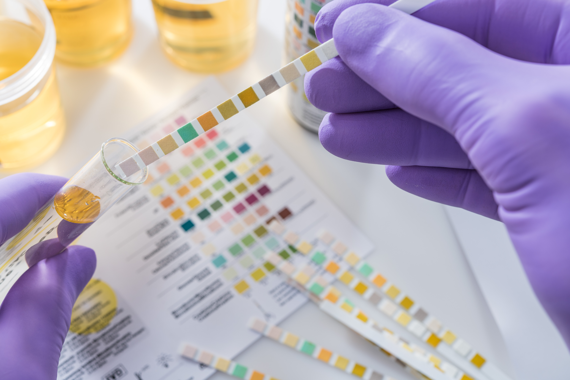 A person wearing purple gloves is holding a test strip in their hand.