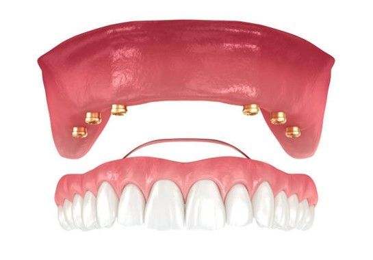A close up of a person's teeth with a brace on it.