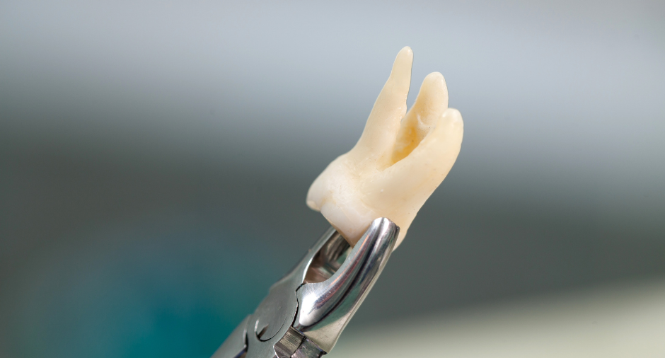 Tooth held by metal tool against a blurred gray background