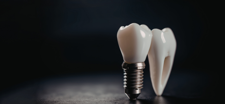 Two white dental crowns and a tooth on a dark background