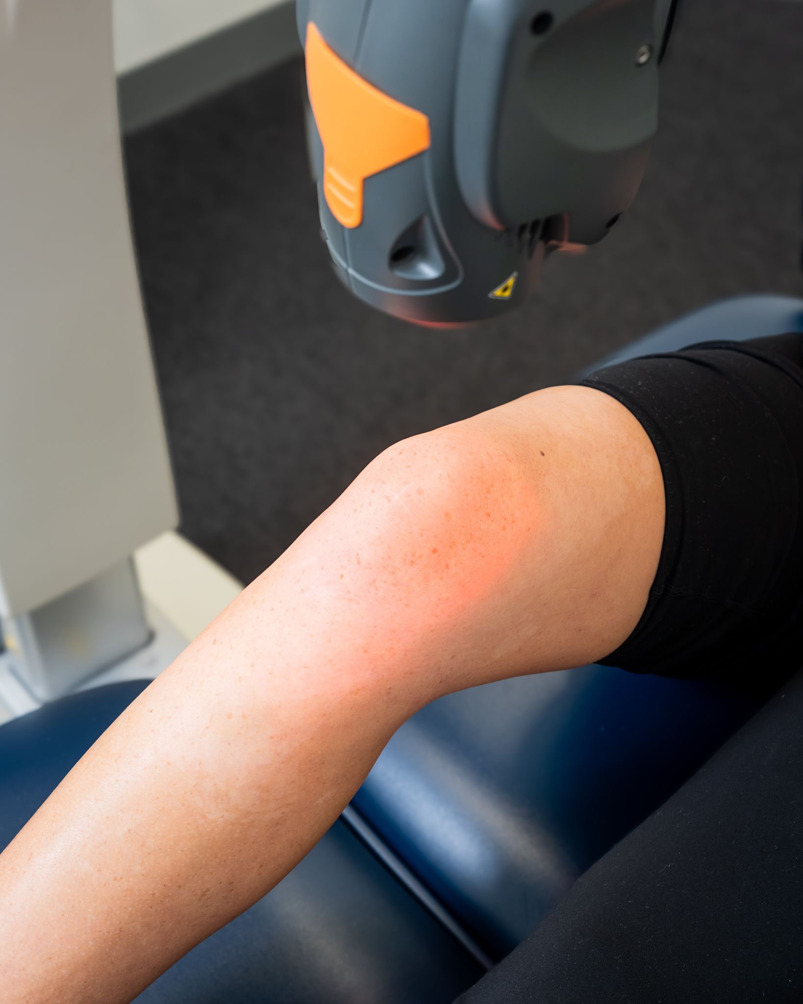 Laser therapy device treating a person's knee. Red laser light is applied to the skin.